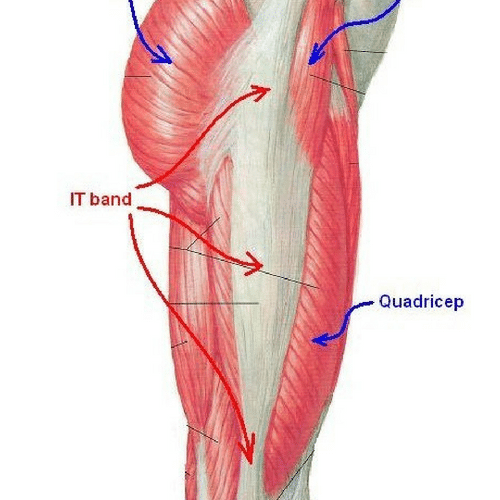 IT Band Syndrome- Lori Duncan PT