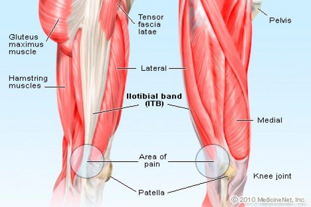 IT Band Syndrome- Lori Duncan PT